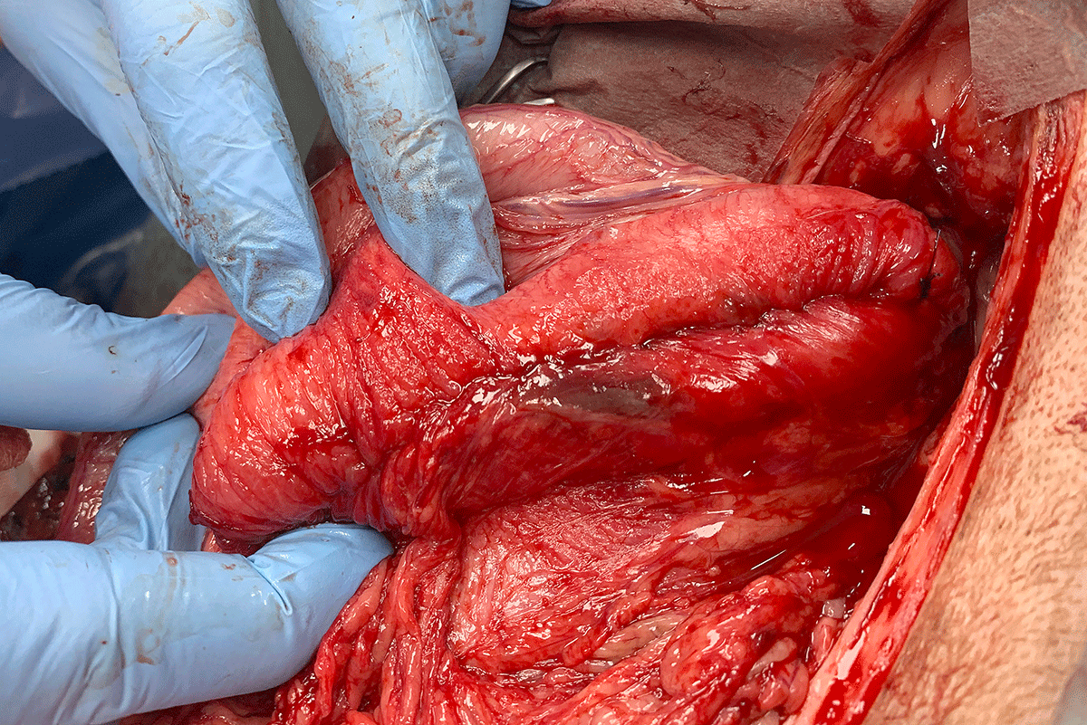 sutura gastrica