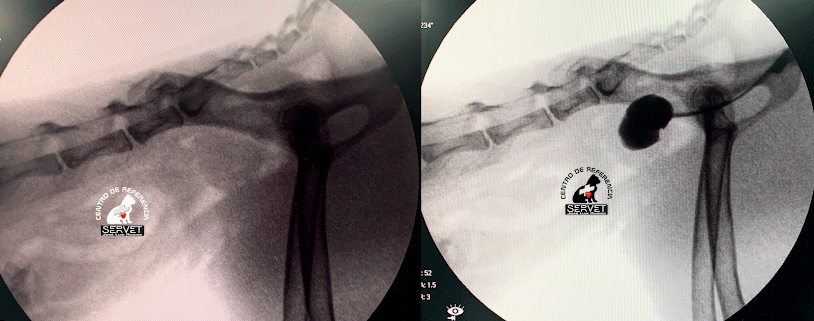 Fluoroscopia vesical con contraste