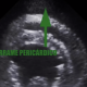 Tamponamiento cardíaco servet urgencias veterinarias