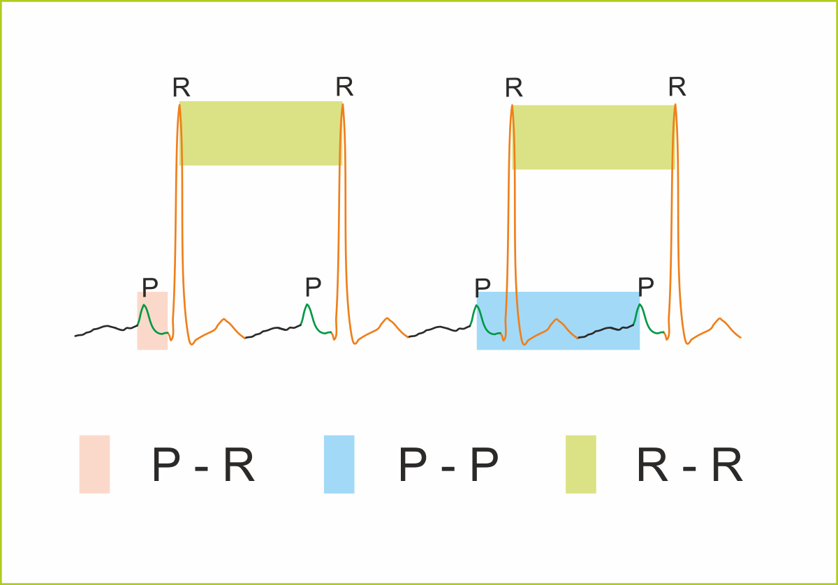 ELECTROCARDIOGRAMAS