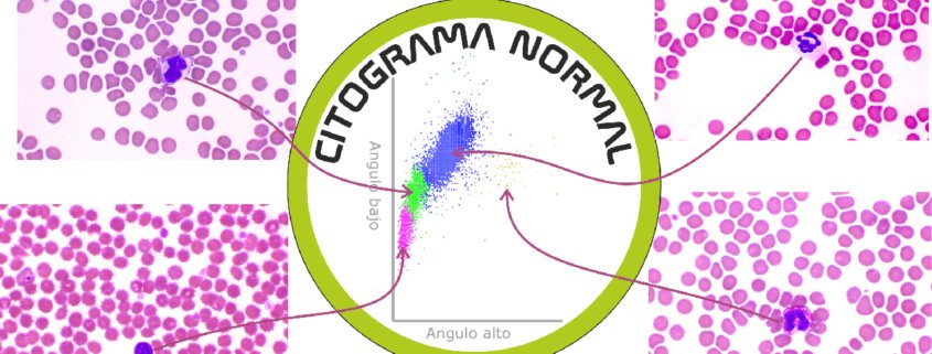 Citograma y su citología asociada