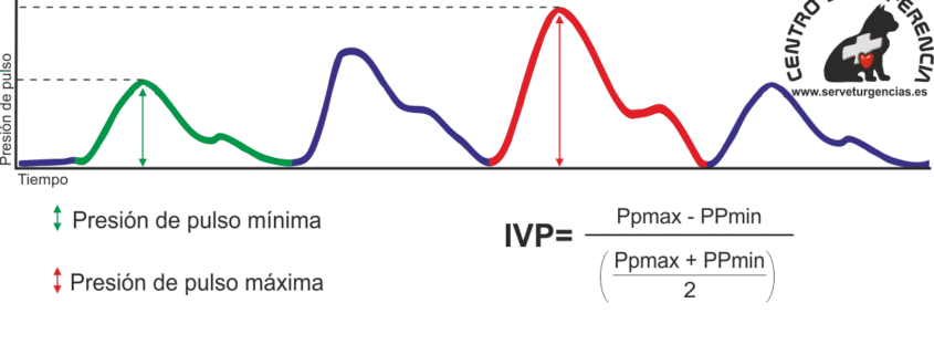 indice de variabilidad pletismográfica