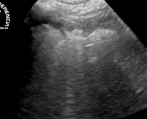 Edema agudo de pulmón servet urgencias veterinarias