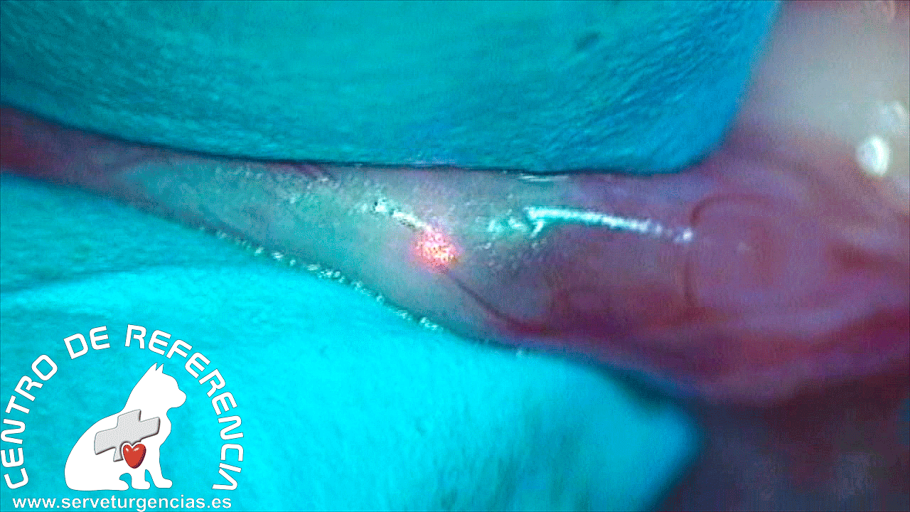 01-web Microcirugía obstrucción uréter Servet Urgencias