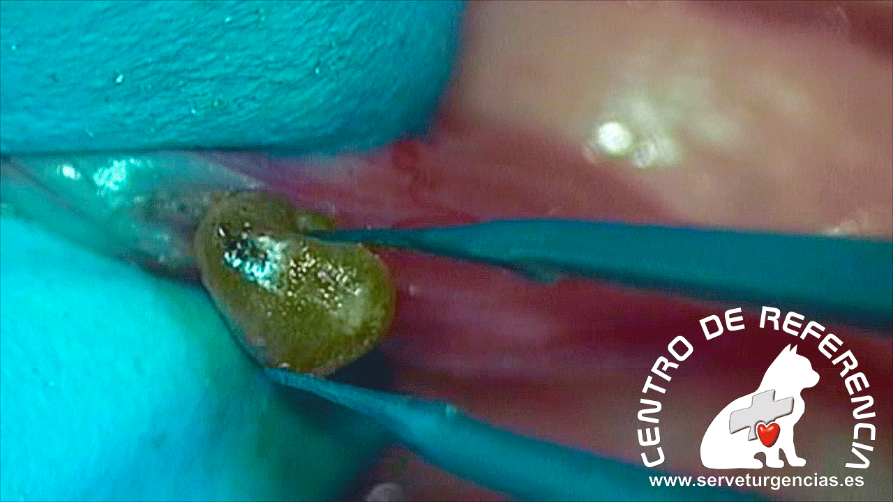 04 cálculo ureter gato microcirugía láser