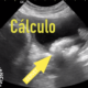 Cálculo y Pólipo urinarios